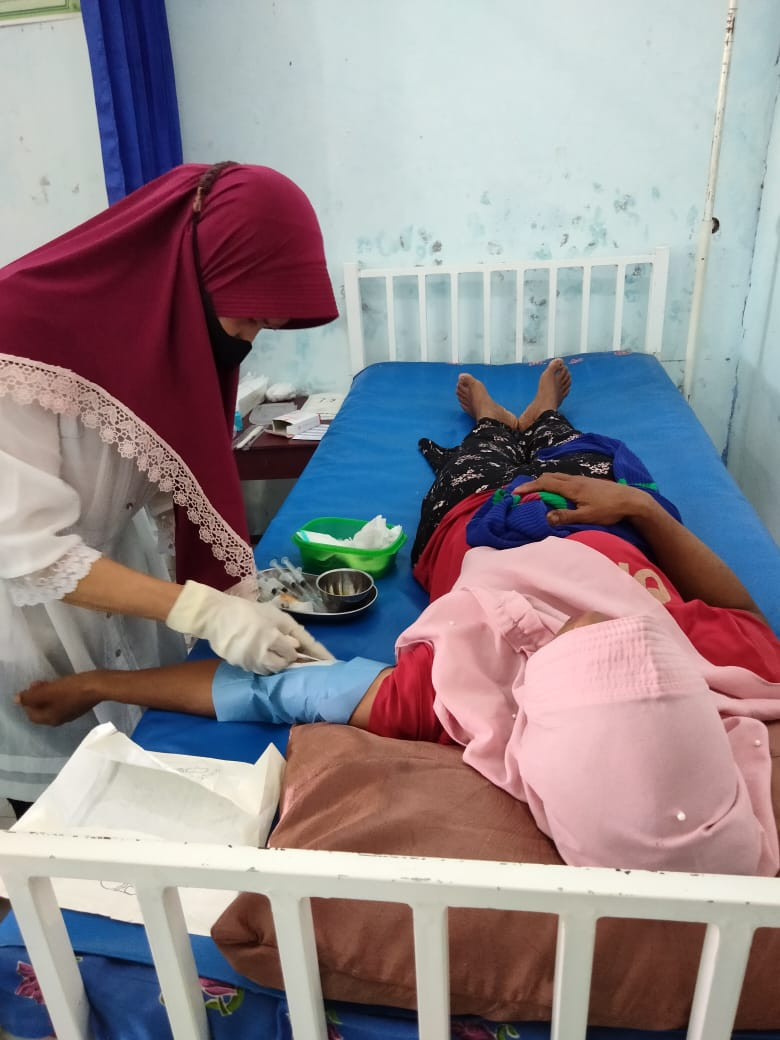 Pelayanan KB MKJP Implan di PBM Deby Rahmawati