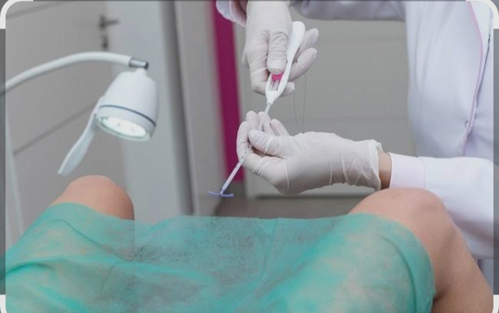 Pemasangan KB IUD